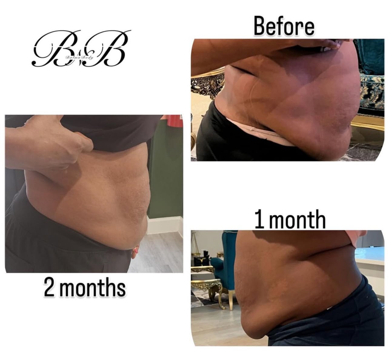 Body sculpting before and after progress results at Balm n Body in Sugar Land TX